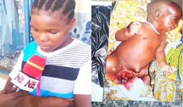 Buhari To Undergo Another Joystick Surgery In UK (Disturbing Photo)